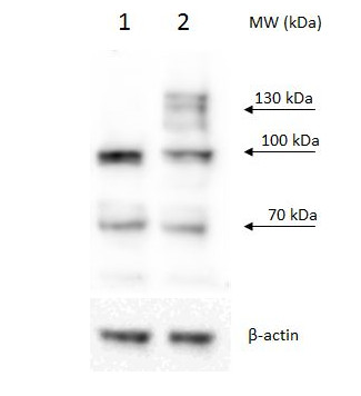 Western blot using anti/PRP40b antibodies